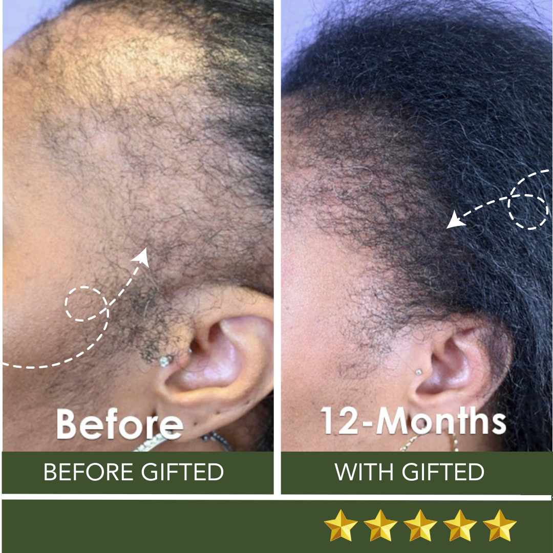 The Complete Hair Revival Kit