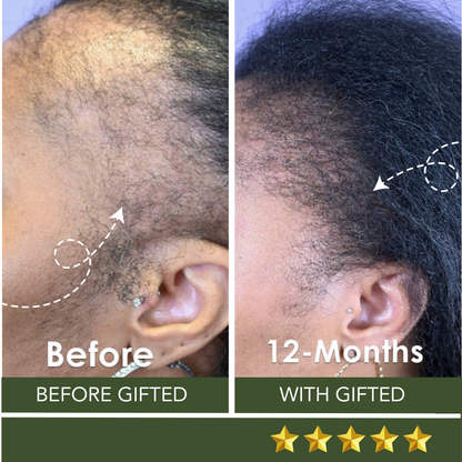 The Complete Hair Revival Kit