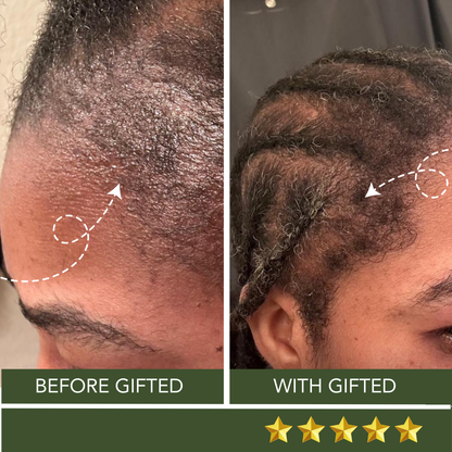 The Complete Hair Revival Kit